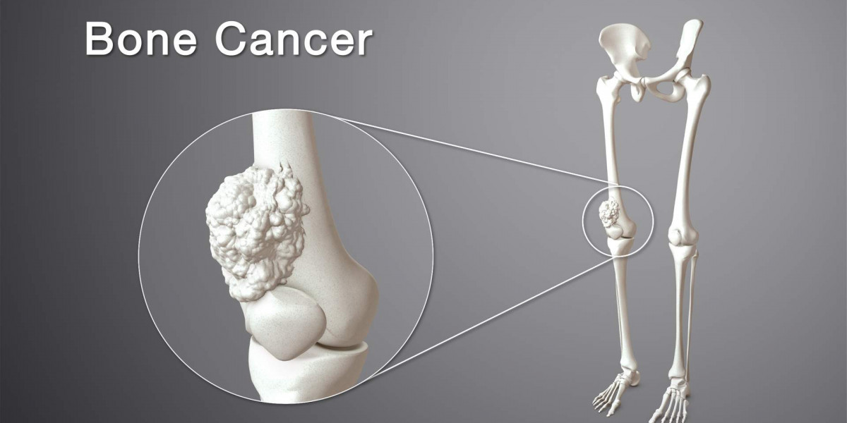 Bone Cancer