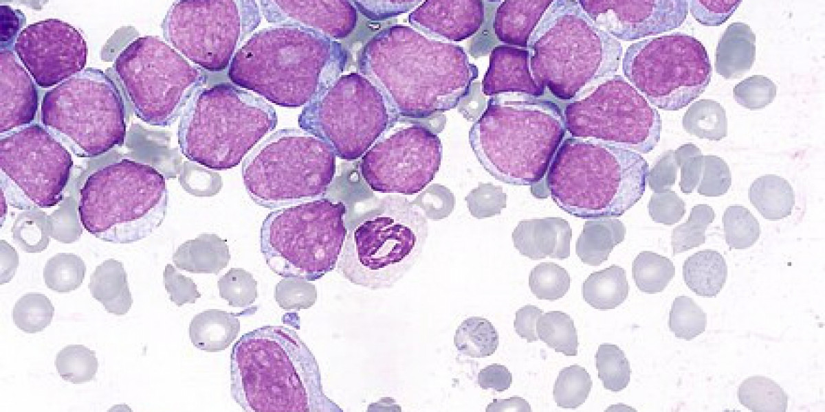 Acute Myeloid Leukemia (AML)