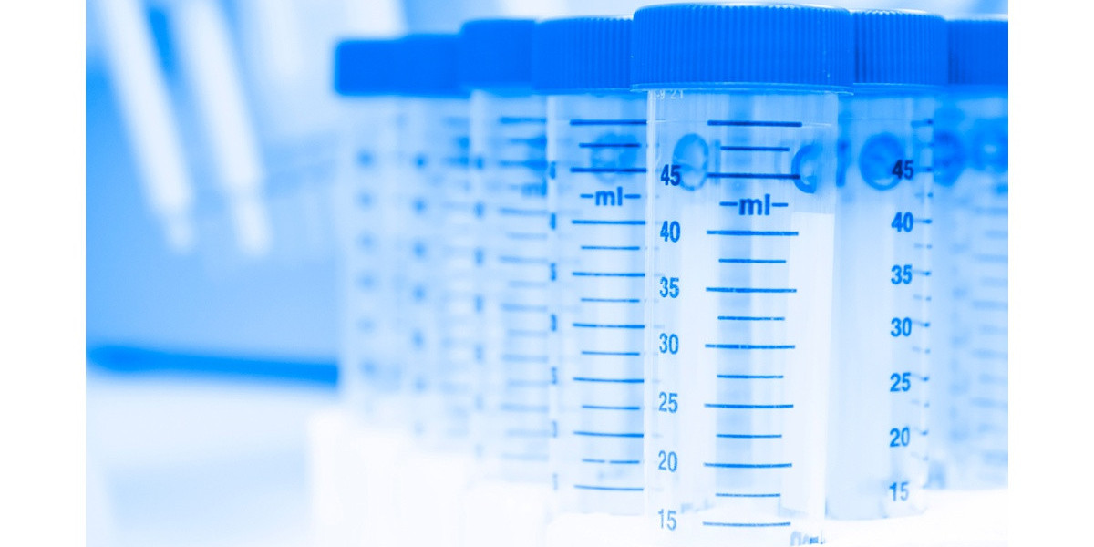 At-home Prostate Cancer Test May Help Some Men Avoid Biopsy