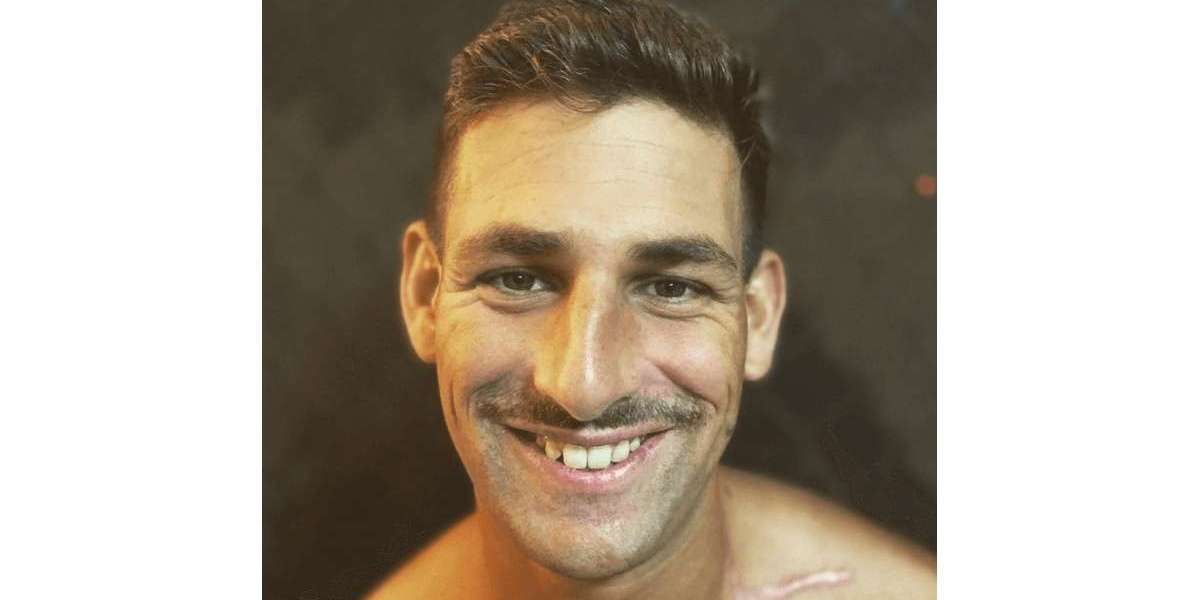 Steve’s Stage 3C Non-Seminoma Germ Cell Metastatic Testicular Cancer Story